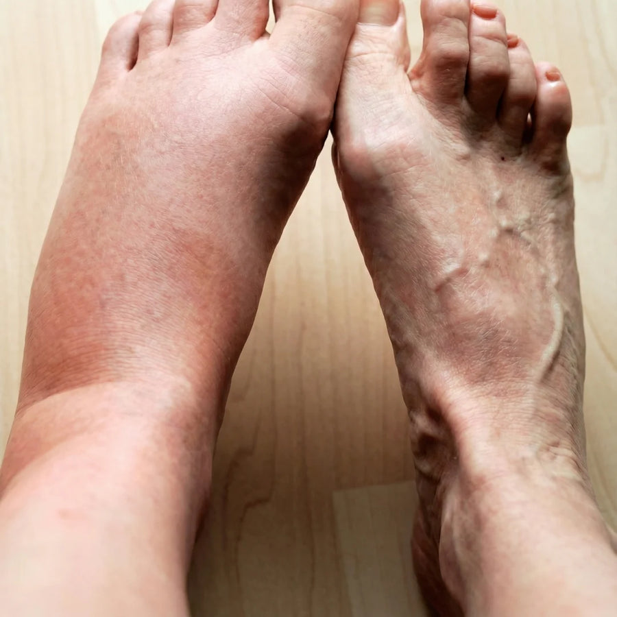Extra Room for Swollen Feet and Sensitive Toes